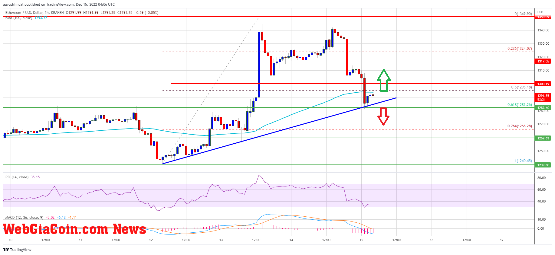 Ethereum Price